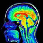 Vagus Nerve